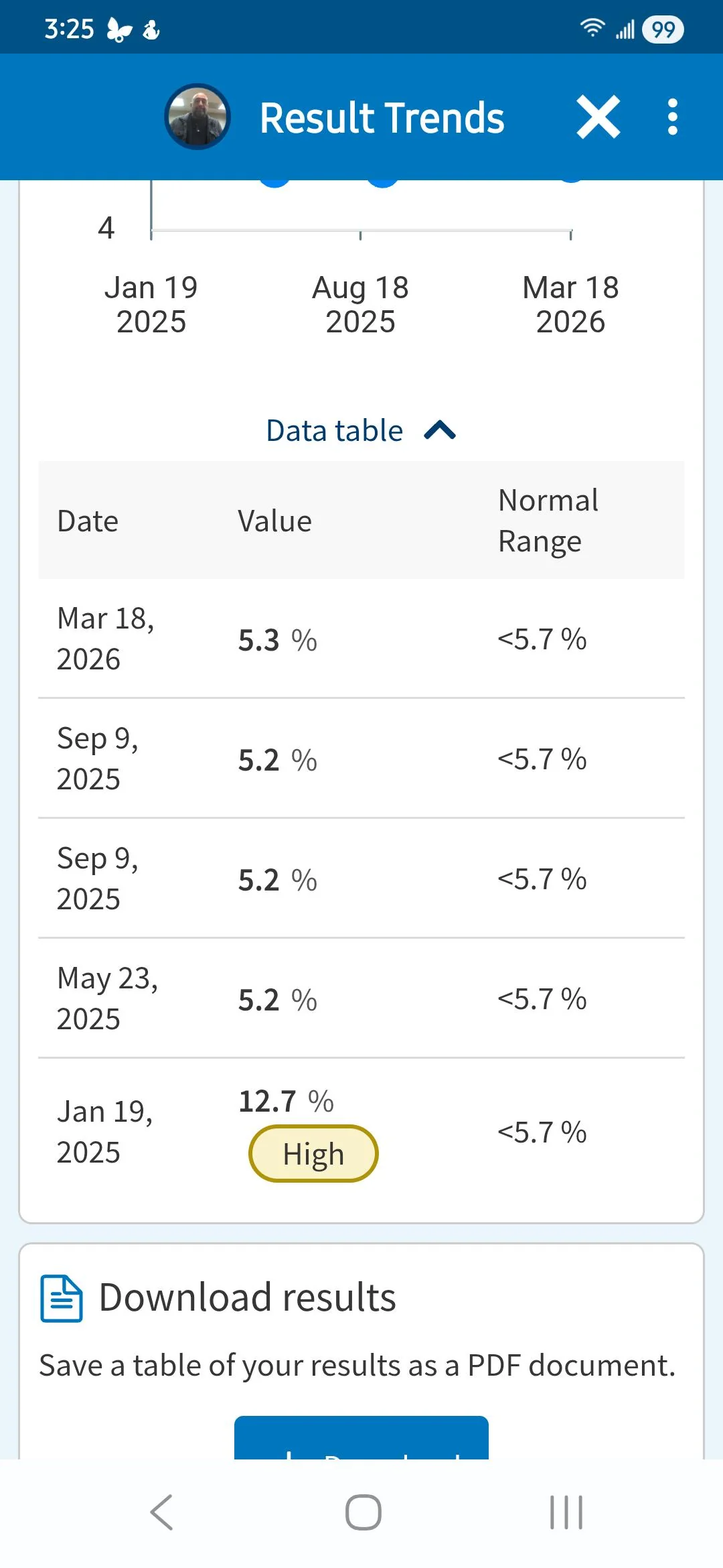 A1C results showing drop from 12.7 to 5.3